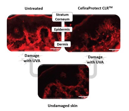 Fig. 3: Visualización in situ de la oxidación de proteínas en profundidad en explantes de piel humana tras la radiación UV-A. 