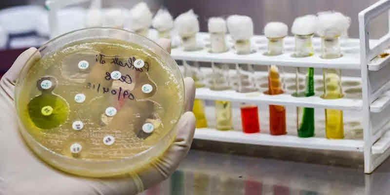 La Importante del Análisis Antibiograma en la Industria