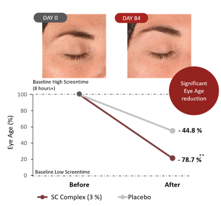 Figura 9: El tratamiento reduce la edad ocular significativamente y compensa el aumento del tiempo de pantalla